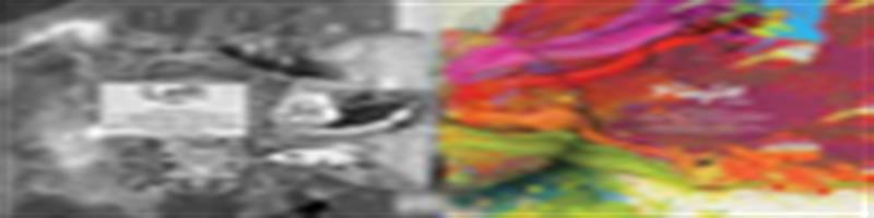 نیمکره های راست و چپ